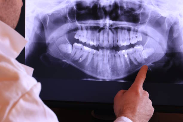 Best Same-Day Emergency Dentist in Fairlea, WV
